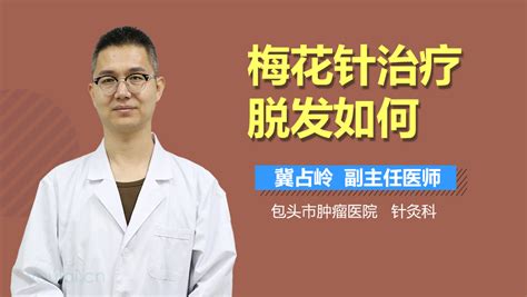 梅花针治疗脱发使用方法,梅花针治疗脱发使用方法视频教程缩略图