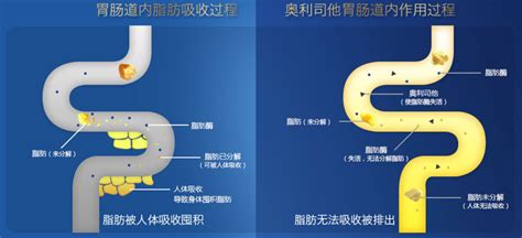 赛乐赛减肥真的有效吗,赛乐赛减肥真的有效吗会反弹吗缩略图