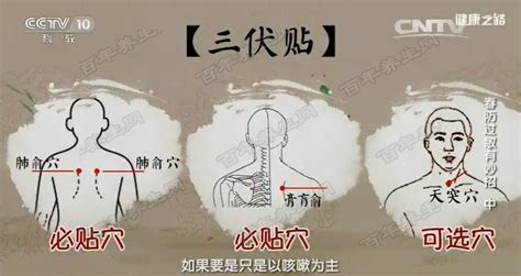 三伏贴贴的正确位置图,三伏贴贴的正确位置图祛湿气缩略图