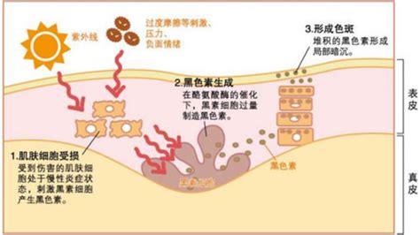 祛斑最好的方法 目前最有效的(祛斑最好的方法目前最有效的30个)缩略图